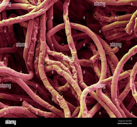 Las Bacterias De ántrax Color Análisis Micrografía De Electrones Sem