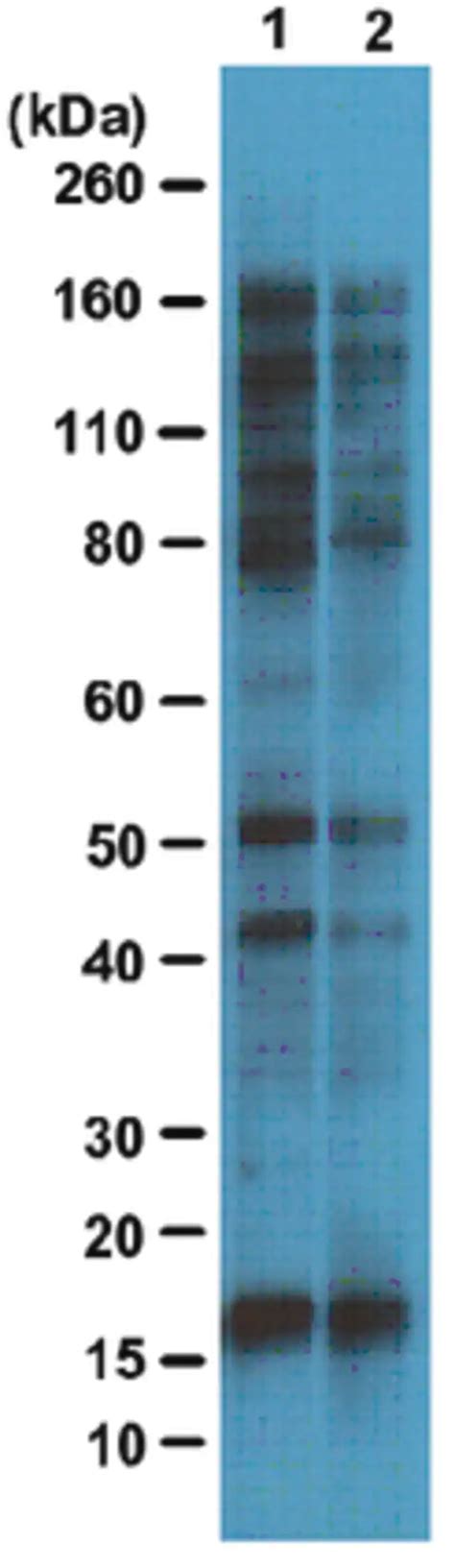 Anti O Glcnac Antibody Clone D E