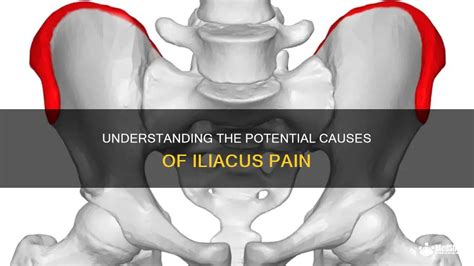 Understanding The Potential Causes Of Iliacus Pain | MedShun