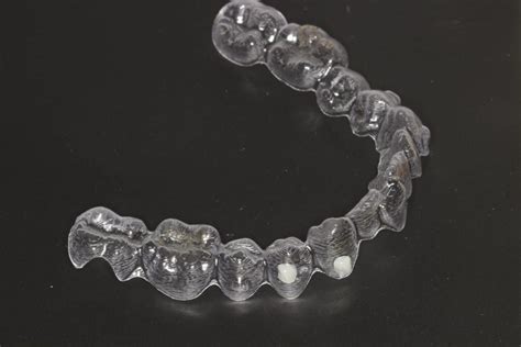 Qué son los ataches de Invisalign y para qué sirven