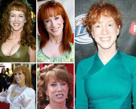 Kathy Griffin Plastic Surgery Before and After Nose Job, Botox ...