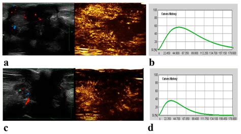 Diagnostics Free Full Text Multiparametric Contrast Enhanced