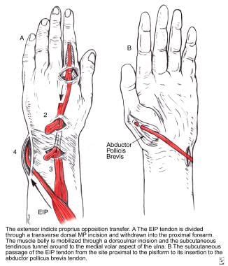 Thumb Muscle Anatomy - Anatomical Charts & Posters