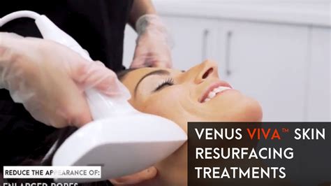 Venus Viva™ Skin Resurfacing Treatments Youtube