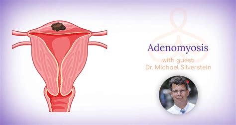 The Difference Between Adenomyosis And Endometriosis Carnegie Womens