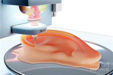 3d Printing Of An Ear Prosthesis Photograph by Patrick Landmann/science ...