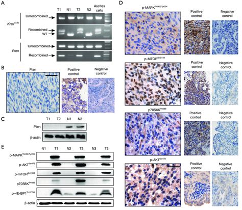 Role Of Kras And Pten In The Development Of The Subcutaneous Lumps A