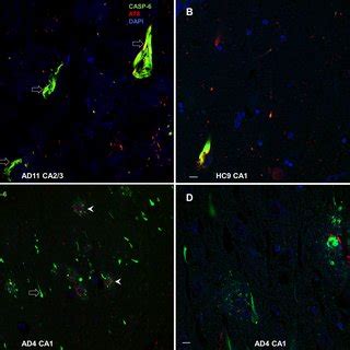 Colocalization Of Casp With Phosphorylated Tau At Cd And