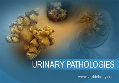 Urinary System Pathologies