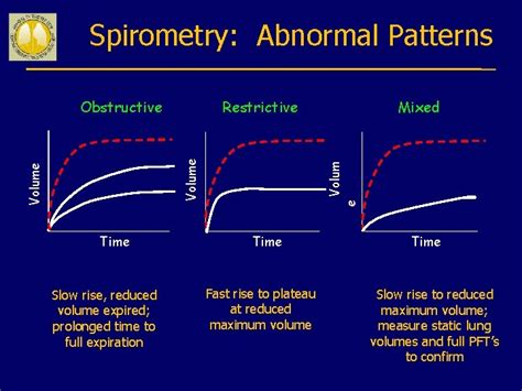 Spirometry In Primary Care Global Initiative For Chronic