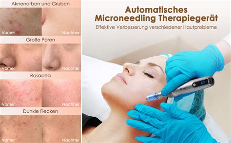 Dr Pen M S Elektrische Microneedling Pen Bestauty Dermapen