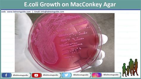 E Coli Diagnosis Procedure And Interpretation Lab Tests Guide