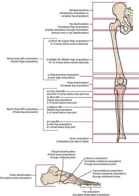 Assessment Of The Amputee Musculoskeletal Key