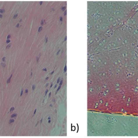 HE-stained sections of cartilage tissue and acellularized cartilage tissue | Download Scientific ...