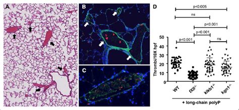 Long Chain Polyphosphates Polyp Promotes Thrombi Formation Platelet