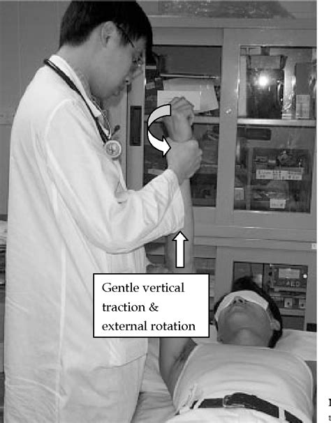 Figure 1 From Reducing Anterior Shoulder Dislocation By The Spaso