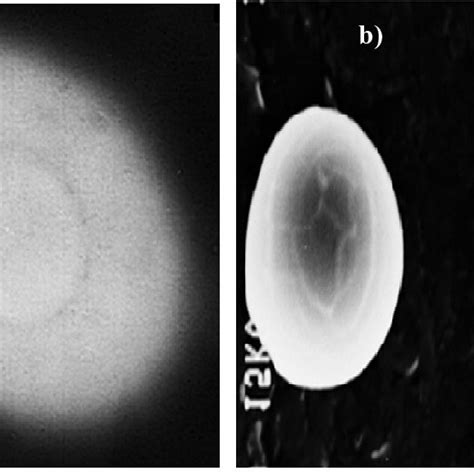 (a) Transmission electron microscopy (TEM) image and (b) scanning ... 