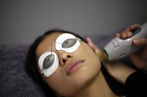 Laser Hair Removal Review - Baked Online