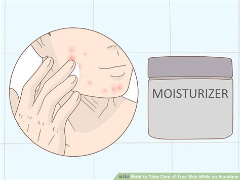 Ways To Take Care Of Your Skin While On Accutane Wikihow