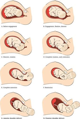 Intrapartum Flashcards Quizlet