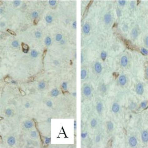 Immunostaining Of Hcc Specimens Implanted Onto The Cam Surface Download Scientific Diagram