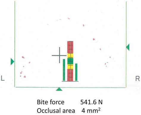 Results of the bite force test. Bite force and the occlusal area were ...