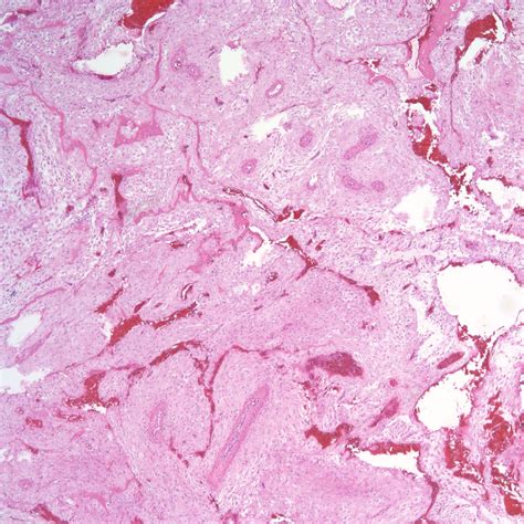 Chapter Placental Perfusion Section A Spiral Arteries Obstetrical