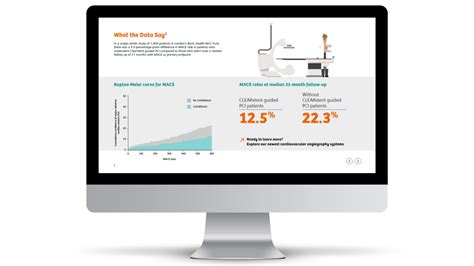 The Future Of Cardiology Imaging Siemens Healthineers Usa