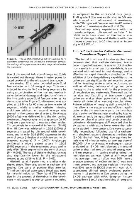 Pdf The Use Of Transducer Tipped Ultrasound Catheter For Recanalization Of Thrombotic Arterial