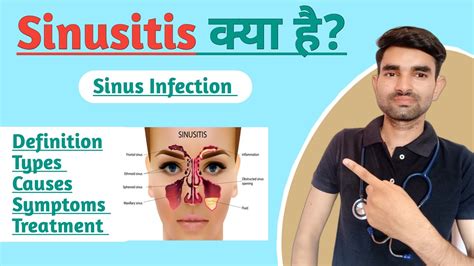 Sinusitis In Hindi Causes Symptoms And Treatment Of Sinusitis YouTube