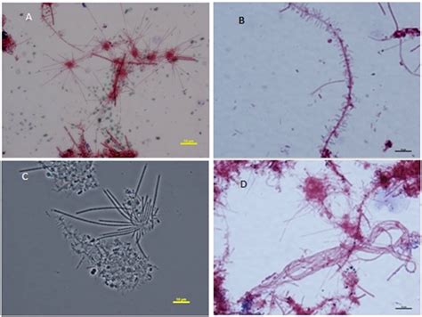 Figure Bright Field And Phase Contrast Micrographs Of Filamentous