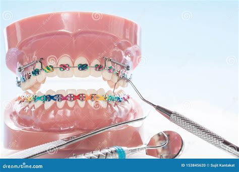 Herramientas Del Dentista Y Modelo Ortod Ntico Foto De Archivo Imagen