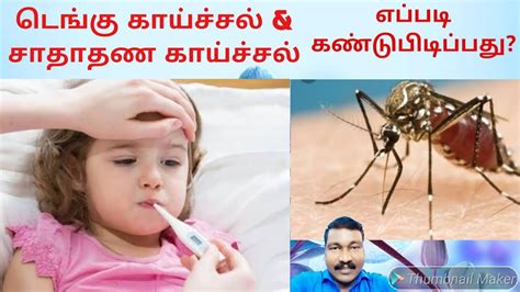 டெங்கு காய்ச்சல் And சாதாரண காய்ச்சல் என்ன வித்தியாசம் Dengue Fever Youtube