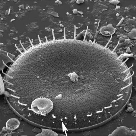 Image Stephanodiscus Rimoportula Species Diatoms Of North America