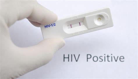 Hiv Test Online Un Cares