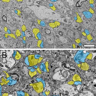 Synaptic Organization Of The Neuropil In The Human Temporal Lobe