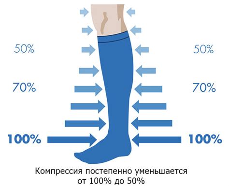 Чулки после эндопротезирования тазобедренного сустава: как долго носить