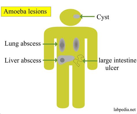 Amoebiasis Life Cycle