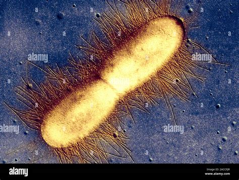 E Coli Bakterium Farbige Transmission Electron Micrograph TEM Einer