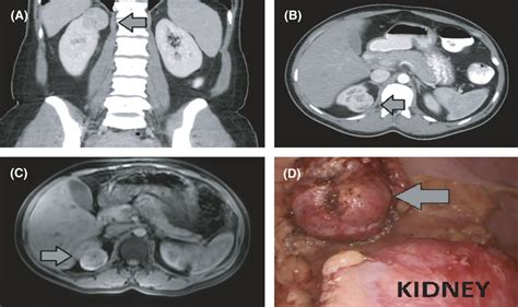 AC Abdominal Computed Tomography And Magnetic Resonance Imaging Show