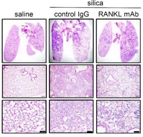 Pulmonary Osteoclast Like Cells In Silica Induced Pulmonary Fibrosis