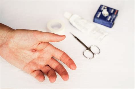 Premium Photo Torn Callus Of The Hand Closeup Rough Skin Of Male Hand