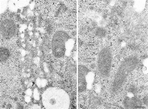 EM In Situ Hybridization Of Huh 7 Cells Harboring A Subgenomic HCV