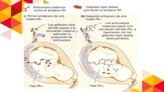 Enfermedad Hemol Tica Del Reci N Nacido Ppt Descarga Gratuita