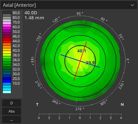 Topography Optopol Technology Ophthalmic Diagnostic Equipment