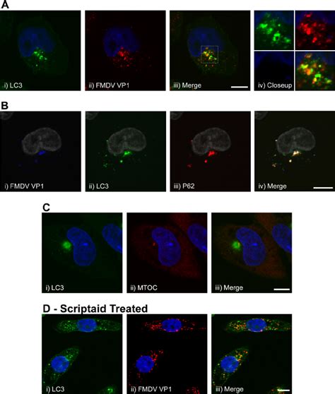 Localization Of Gfp Lc3 P62 And Vp1 Capsid Protein In Cells Infected