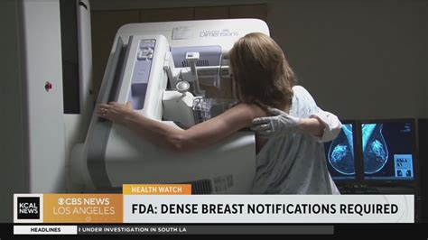 Health Watch New Fda Breast Density Mammography Regulations Youtube