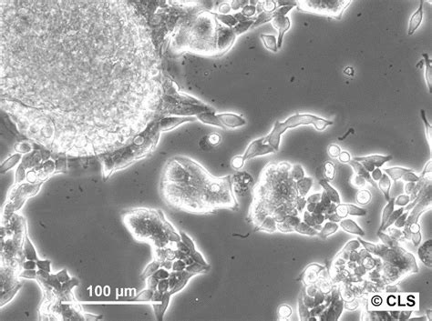 SW-620 Cell Line - Influence on Colon Cancer Research and Experimentation