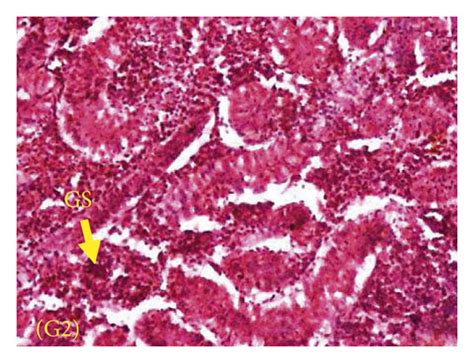 (a–d) Histology of kidney. G1 showed normal structure of renal tubules ...