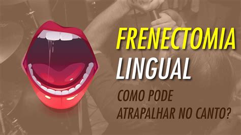 Frenectomia Lingual Como Pode Atrapalhar No Canto L Ngua Presa